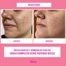 Gel esfoliante Facial Acne Defense