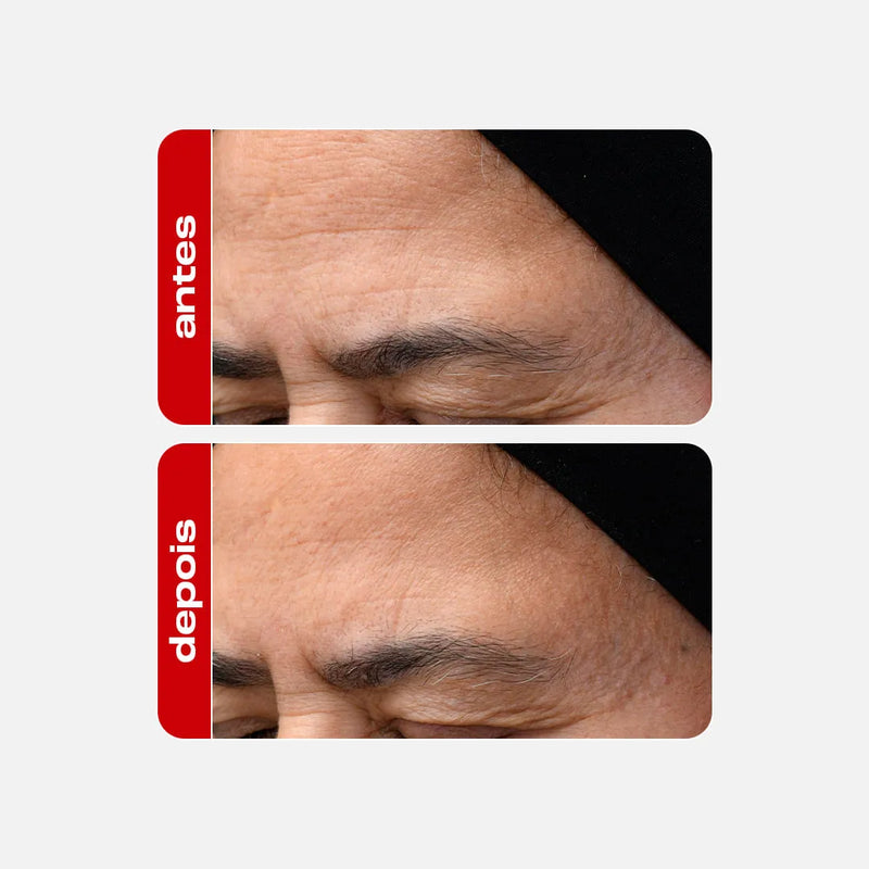 Sérum Facial Retinal 30g