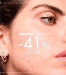 Normaderm Double Correction