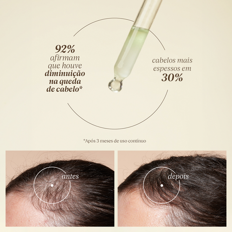 Sérum Tratamento Capilar Antiqueda Aromacologia 50ml