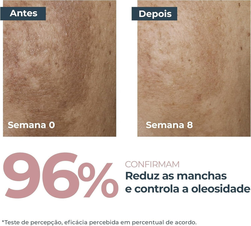 Anti-Pigment Sérum Ultraleve Pele Oleosa 30 ml